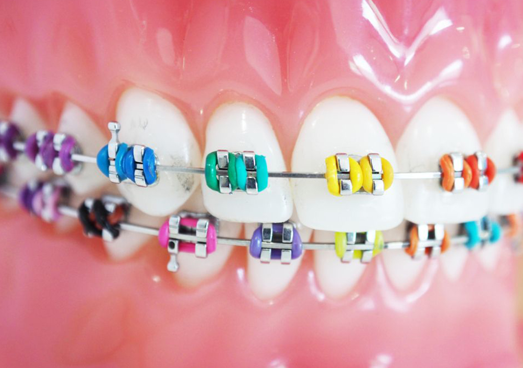 Img Orthodontic