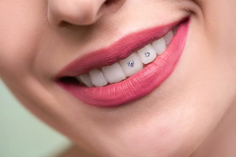 Img Dental Jewellery